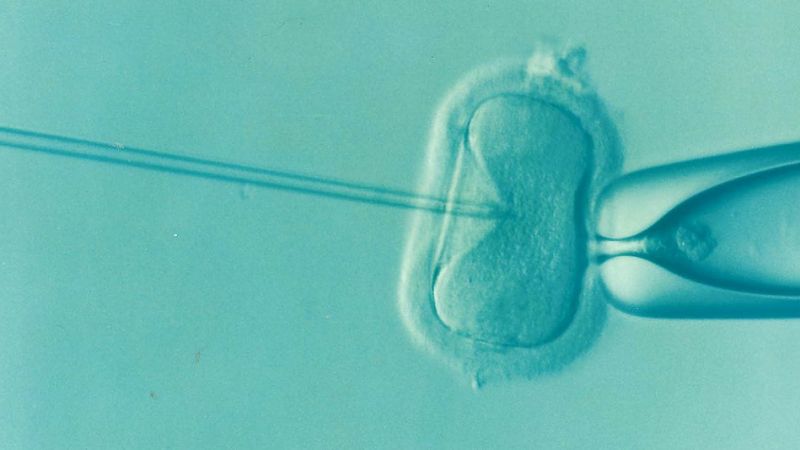 In vitro fertilizace (IVF) - klikněte pro zobrazení detailu