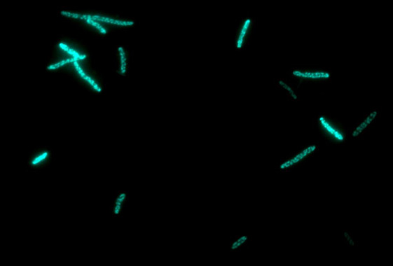 Bakterie E. Coli - klikněte pro zobrazení detailu