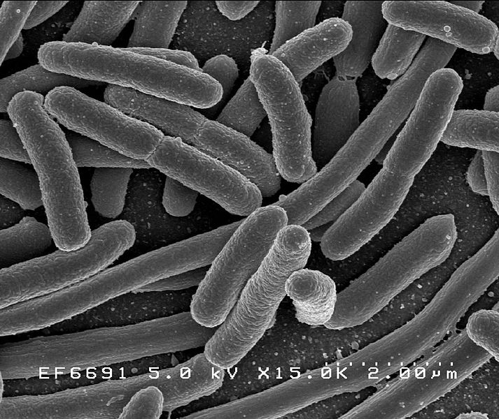 Bakterie e-coli - klikněte pro zobrazení detailu