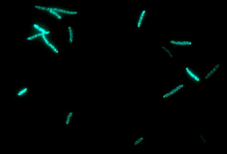 zobrazit detail snímku: Bakterie E. Coli