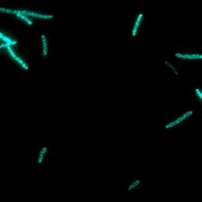 Bakterie E. Coli