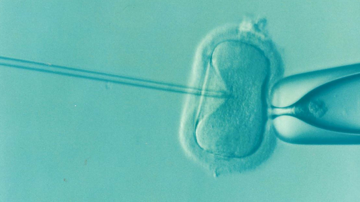 zobrazit detail snímku: In vitro fertilizace (IVF)