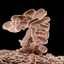 E-coli