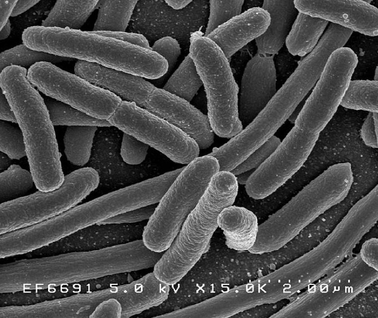zobrazit detail snímku: Bakterie e-coli