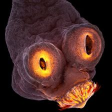 Taenia solium.