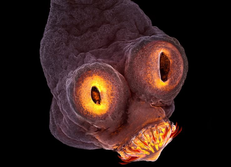 zobrazit detail snímku: Taenia solium.