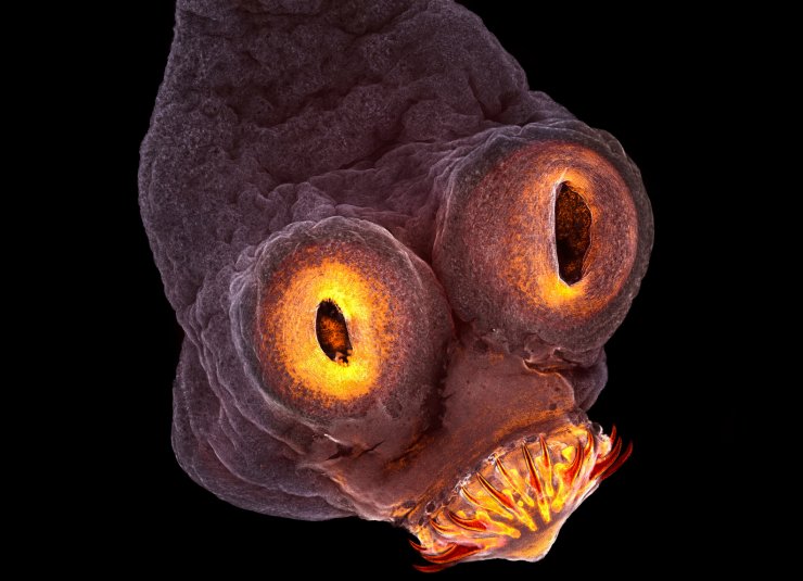 zobrazit detail snímku: Taenia solium.