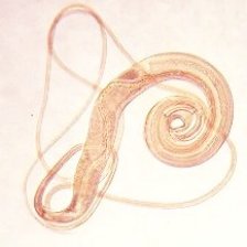 Tenkohlavec liščí (Trichuris vulpis)