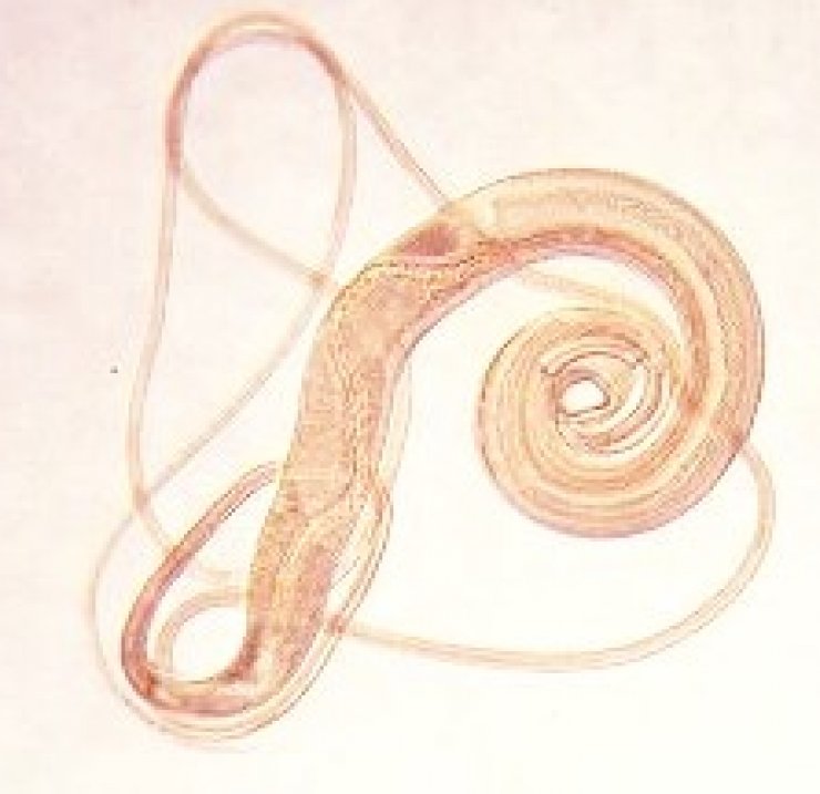 zobrazit detail snímku: Tenkohlavec liščí (Trichuris vulpis)