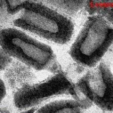 Virus vztekliny