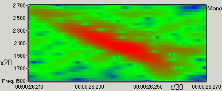 zobrazit detail snímku: Sonogram