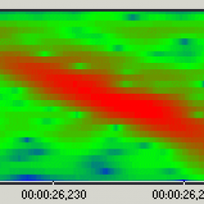 Sonogram